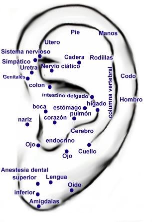 auriculoterapia auriculoterapia