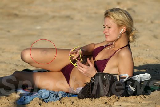 Paris Hilton Private Photos Look at those ugly scars