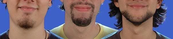 barbixa's