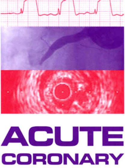 Acute Coronary Syndromes Third Edition
